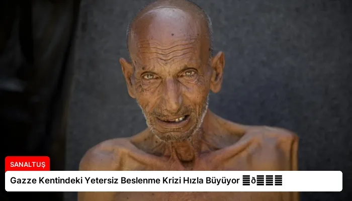 Gazze Kentindeki Yetersiz Beslenme Krizi Hızla Büyüyor ⏬👇